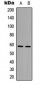Anti-AIOLOS Antibody